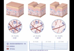 都在問(wèn)的乙酰殼糖胺（NAG）功效怎么樣？功效成分的護(hù)膚品應(yīng)該怎么選？